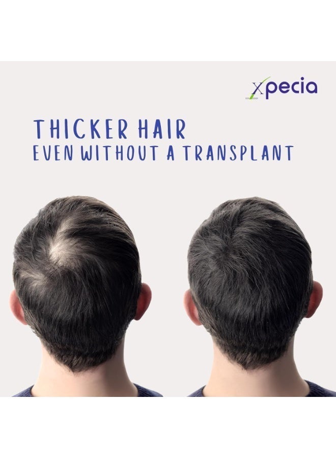 XPECIA Men’s DHT Blocker Tablets – Supports New Hair Growth & Hair Strength, 60 Tablets - Image 4